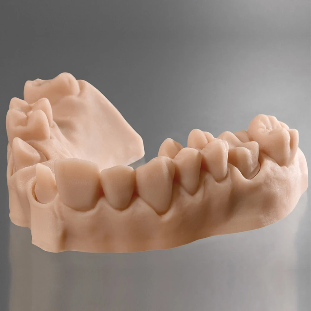 Orthodontic Models For Dlp 3d Printing